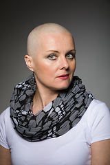 Image showing beautiful woman cancer patient without hair