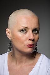 Image showing beautiful woman cancer patient without hair