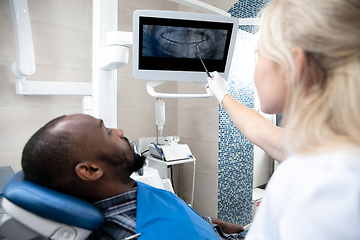 Image showing Young african-american man visiting dentist\'s office