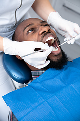 Image showing Young african-american man visiting dentist\'s office, looks scared
