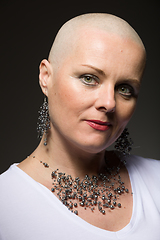 Image showing beautiful woman cancer patient without hair