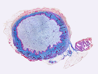 Image showing Urinary bladder micrograph
