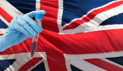 Image showing hand holding test tube with coronavirus blood test