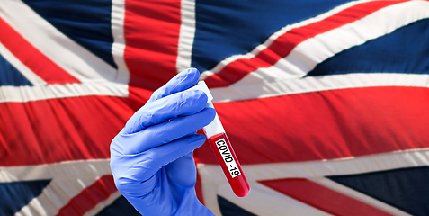 Image showing hand with blood sample in test tube of coronavirus