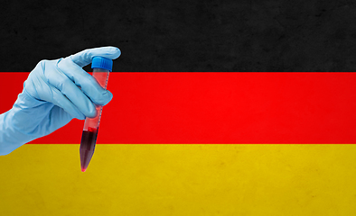 Image showing hand holding test tube with coronavirus blood test