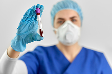 Image showing doctor holding beaker with coronavirus blood test