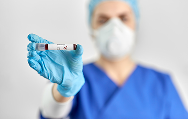 Image showing doctor holding beaker with coronavirus blood test