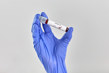 Image showing hand holding beaker with coronavirus blood test