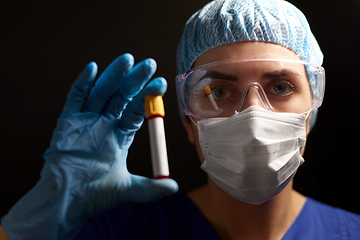 Image showing close up of doctor holding beaker with blood test