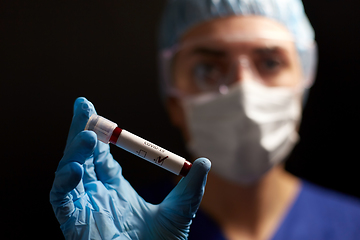 Image showing doctor holding beaker with coronavirus blood test