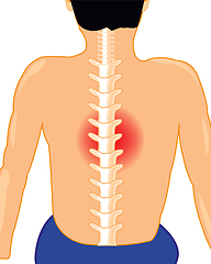 Image showing Man with sick spine on white background is insulated