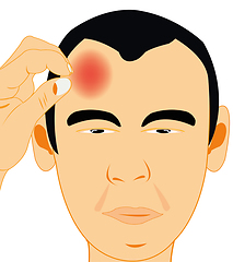 Image showing Vector illustration men beside which pain in head