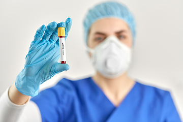 Image showing doctor holding beaker with virus blood test