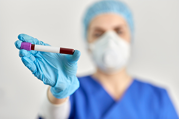 Image showing close up of doctor holding beaker with blood test