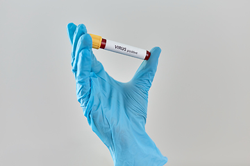 Image showing hand holding beaker with positive virus blood test