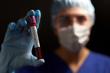 Image showing doctor holding beaker with coronavirus blood test