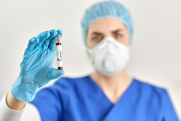 Image showing doctor holding beaker with coronavirus blood test