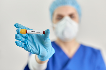 Image showing doctor holding beaker with virus blood test