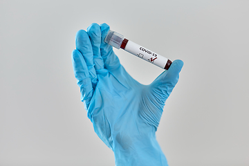 Image showing hand holding beaker with coronavirus blood test