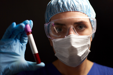 Image showing close up of doctor holding beaker with blood test