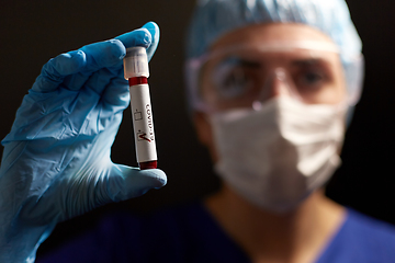 Image showing doctor holding beaker with coronavirus blood test
