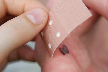 Image showing Plaster and wound