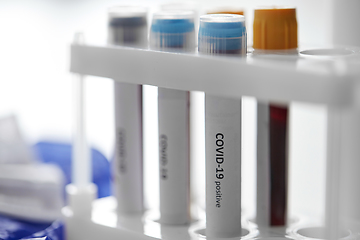 Image showing beakers with coronavirus blood test in holder