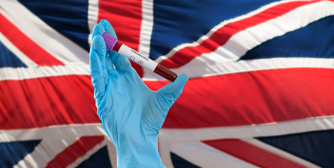 Image showing hand holding beaker with coronavirus blood test