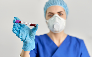 Image showing doctor holding beaker with coronavirus blood test