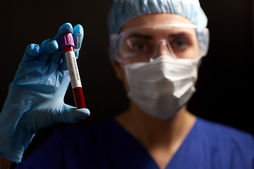 Image showing doctor holding beaker with coronavirus blood test