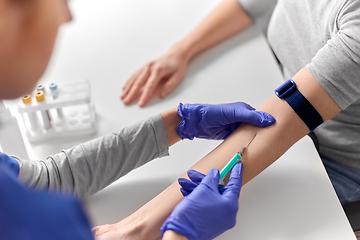 Image showing doctor taking blood for test from patient's hand