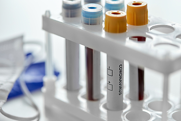 Image showing beakers with coronavirus blood test in holder