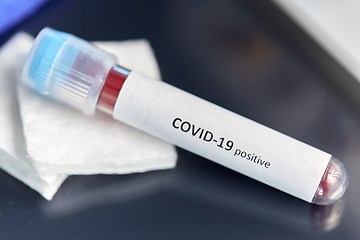 Image showing beaker with coronavirus blood test at laboratory