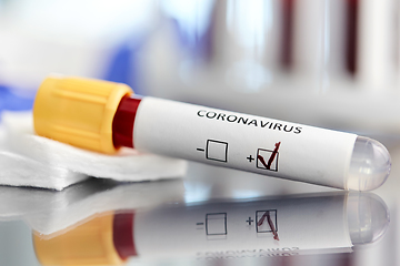 Image showing beaker with coronavirus blood test at laboratory