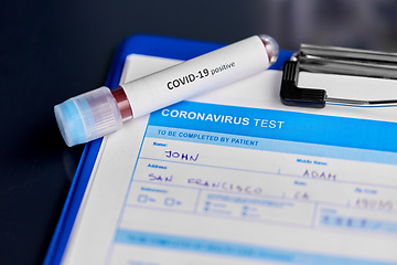 Image showing close up of beaker with coronavirus blood test