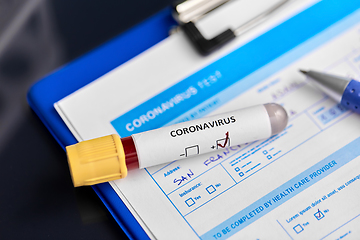 Image showing close up of beaker with coronavirus blood test