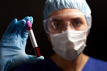 Image showing close up of doctor holding beaker with blood test