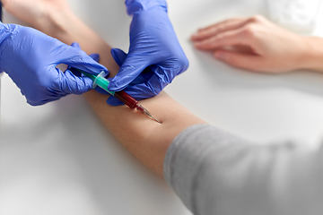 Image showing doctor taking blood for test from patient's hand