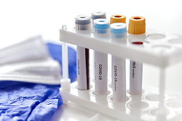 Image showing beakers with coronavirus blood test in holder