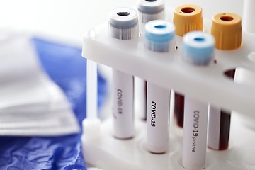 Image showing beakers with coronavirus blood test in holder