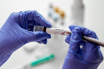 Image showing hand holding beaker with coronavirus blood test