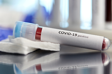 Image showing beaker with coronavirus blood test at laboratory