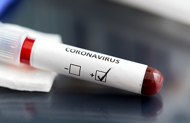 Image showing beaker with coronavirus blood test at laboratory