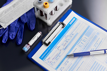 Image showing beaker with coronavirus blood test at hospital