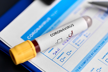 Image showing close up of beaker with coronavirus blood test