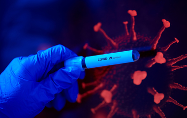 Image showing hand holding beaker with coronavirus blood test