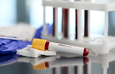 Image showing beaker with virus blood test at laboratory