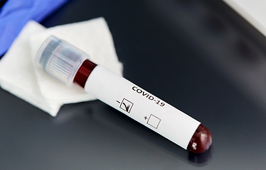 Image showing beaker with coronavirus blood test at laboratory