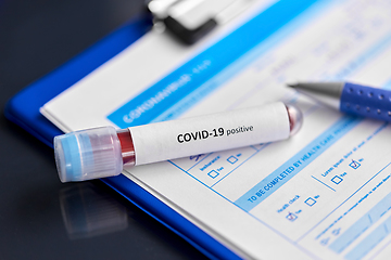 Image showing close up of beaker with coronavirus blood test