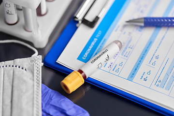 Image showing beaker with coronavirus blood test at hospital